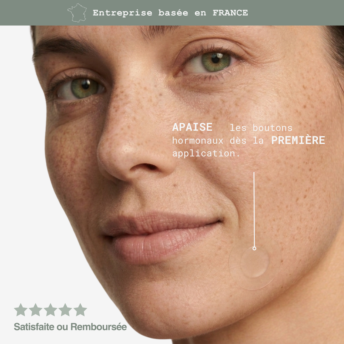 Soin Ciblé Acné Hormonale – Patchs Invisibles