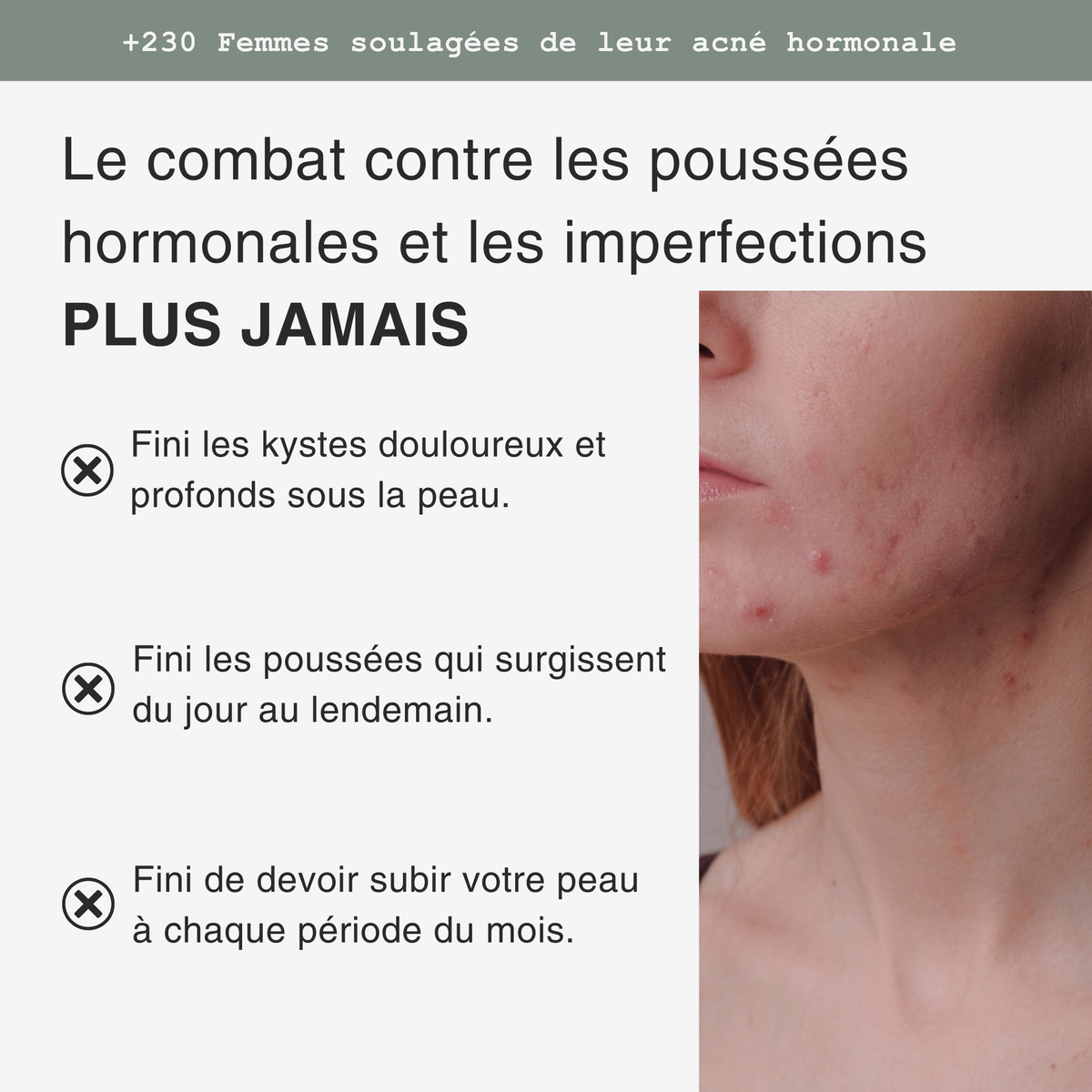 Soin Ciblé Acné Hormonale – Patchs Invisibles