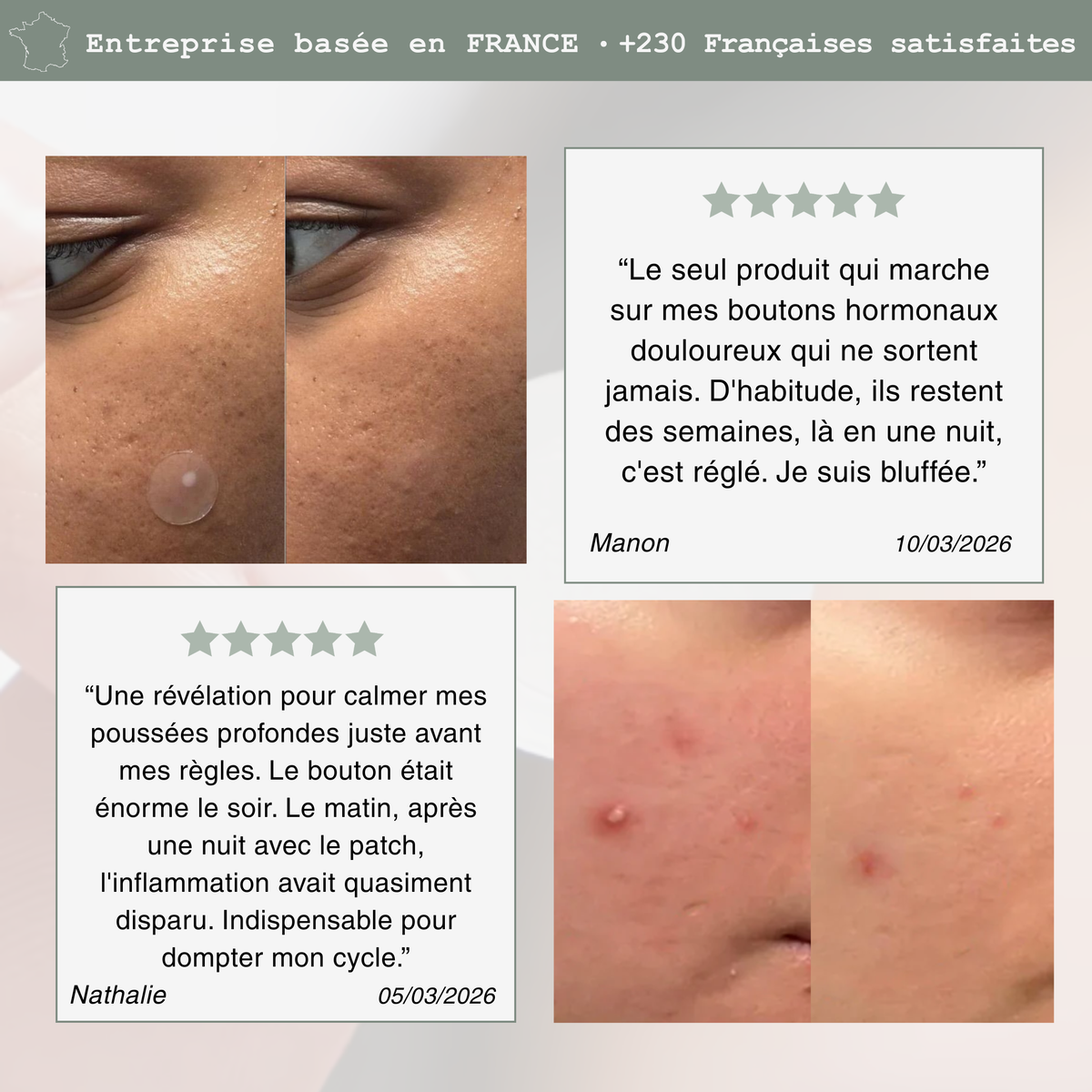 Soin Ciblé Acné Hormonale – Patchs Invisibles