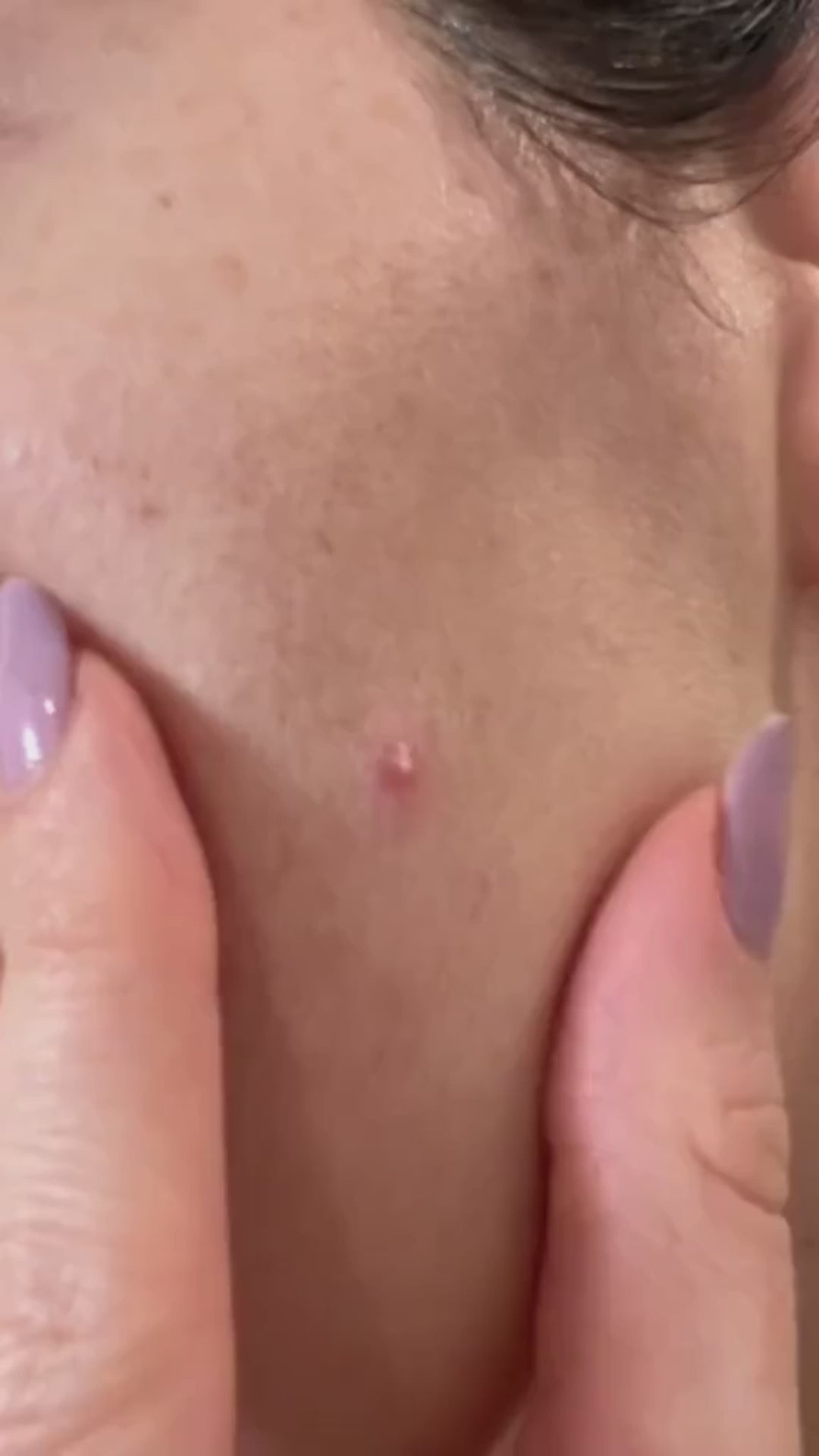 Vidéo